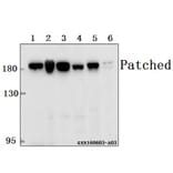 Anti-Patched (A2) Antibody from Bioworld Technology (BS1286) - Antibodies.com