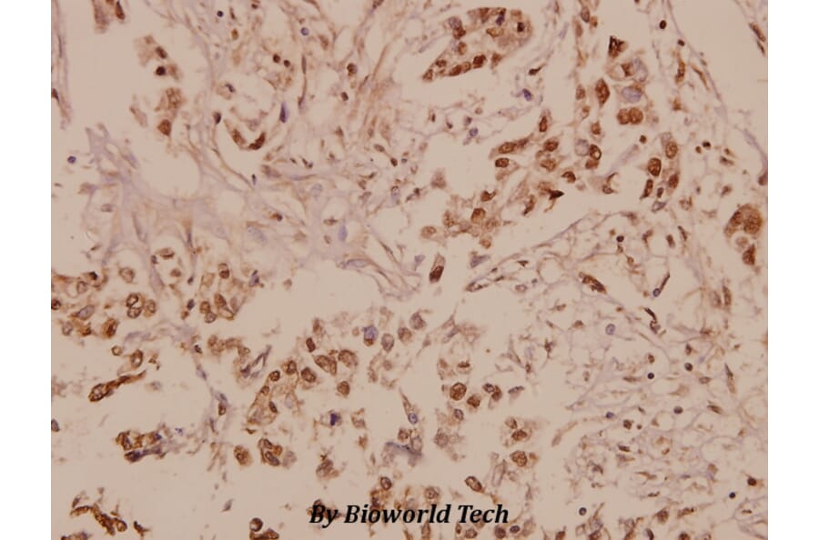Anti-Patched (A2) Antibody from Bioworld Technology (BS1286) - Antibodies.com