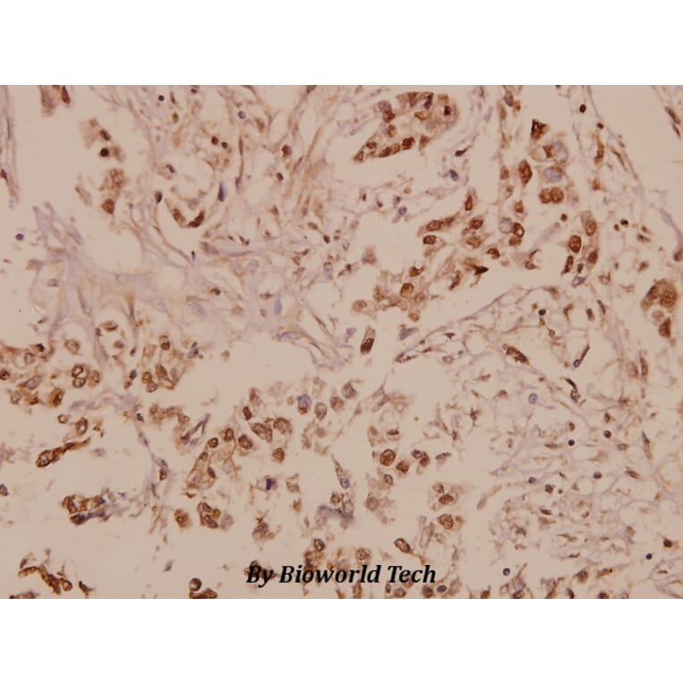 Anti-Patched (A2) Antibody from Bioworld Technology (BS1286) - Antibodies.com