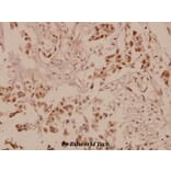 Anti-Patched (A2) Antibody from Bioworld Technology (BS1286) - Antibodies.com