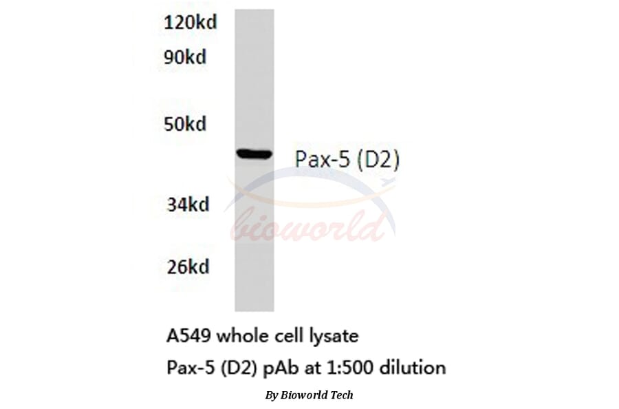 Anti-Pax-5 (D2) Antibody from Bioworld Technology (BS1287) - Antibodies.com