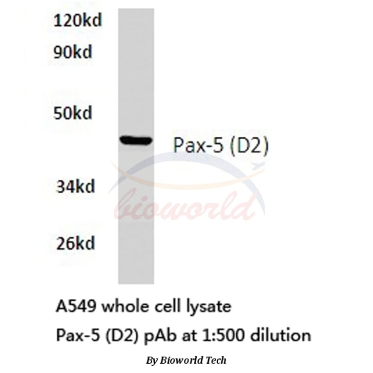 Anti-Pax-5 (D2) Antibody from Bioworld Technology (BS1287) - Antibodies.com