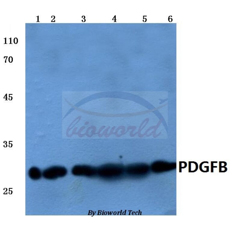 Anti-PDGF-B (L48) Antibody from Bioworld Technology (BS1290) - Antibodies.com