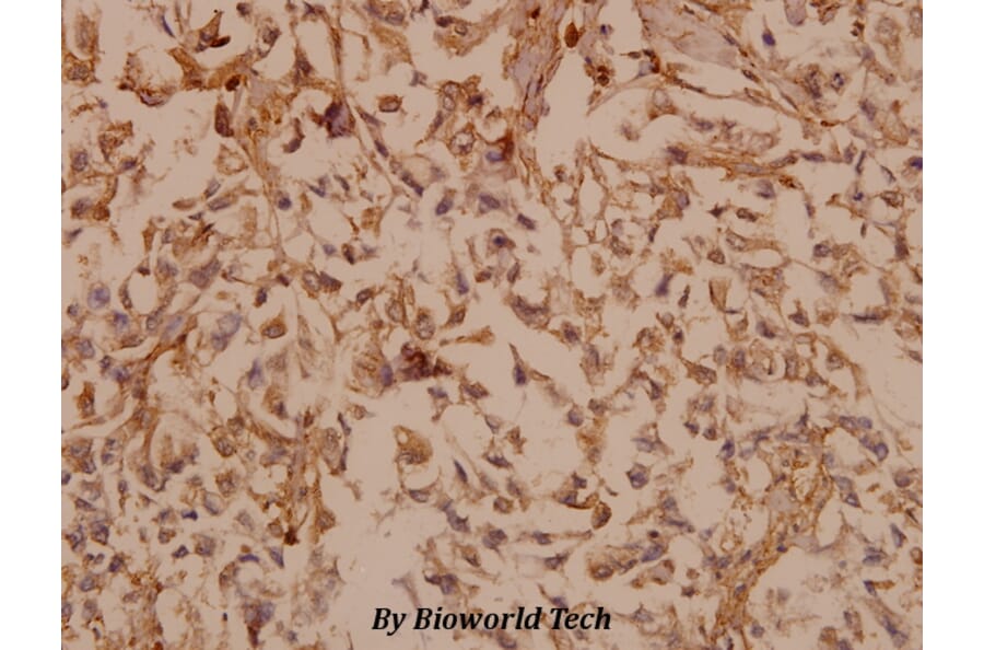 Anti-PDGF-B (L48) Antibody from Bioworld Technology (BS1290) - Antibodies.com