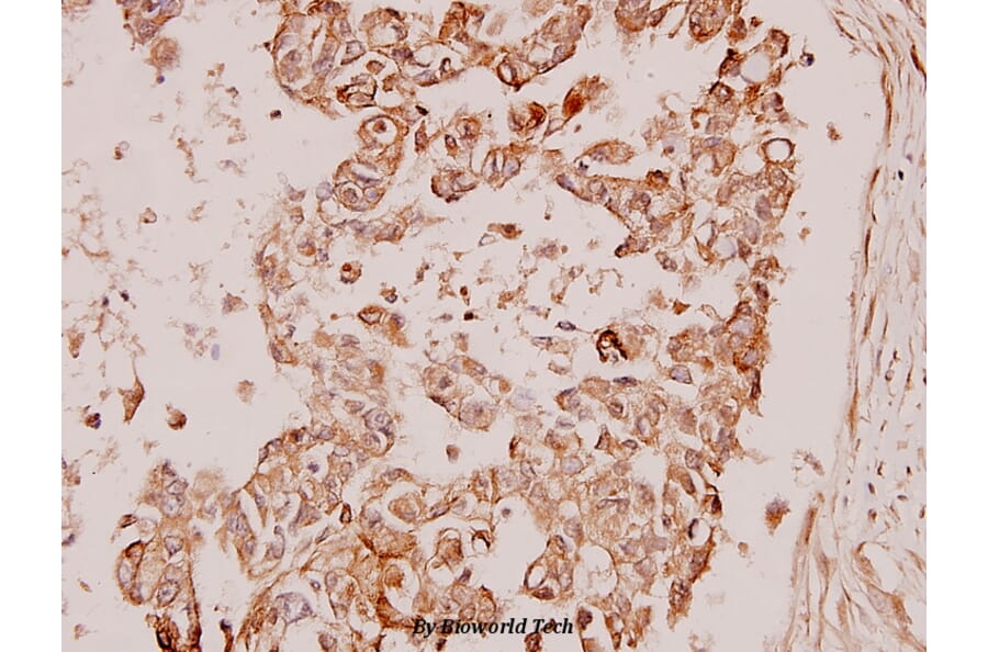 Anti-PDK1 (K235) Antibody from Bioworld Technology (BS1291) - Antibodies.com
