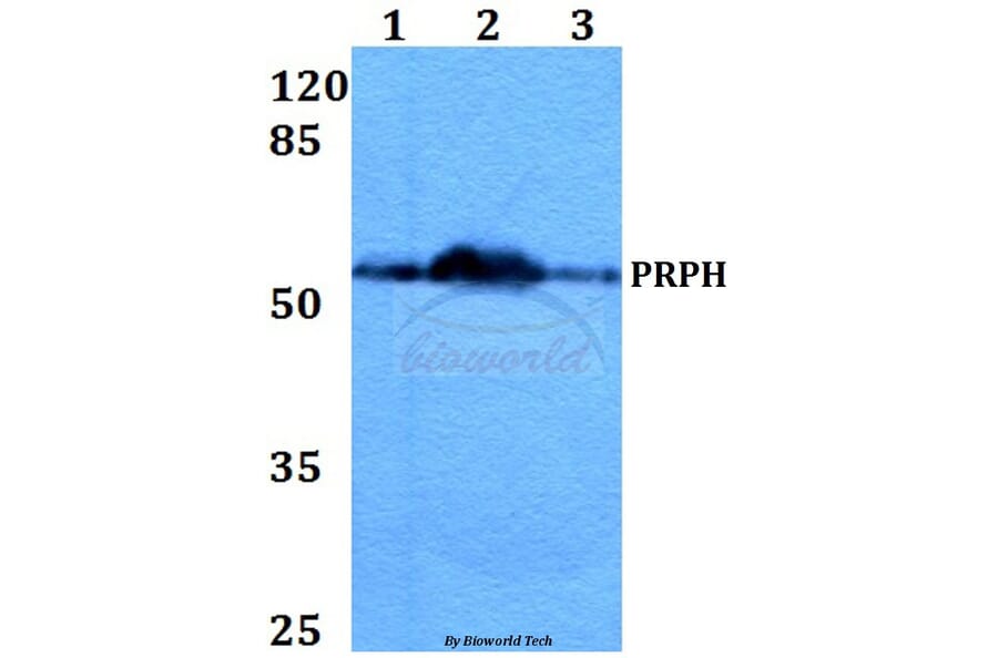 Anti-PRPH (S454) Antibody from Bioworld Technology (BS1292) - Antibodies.com