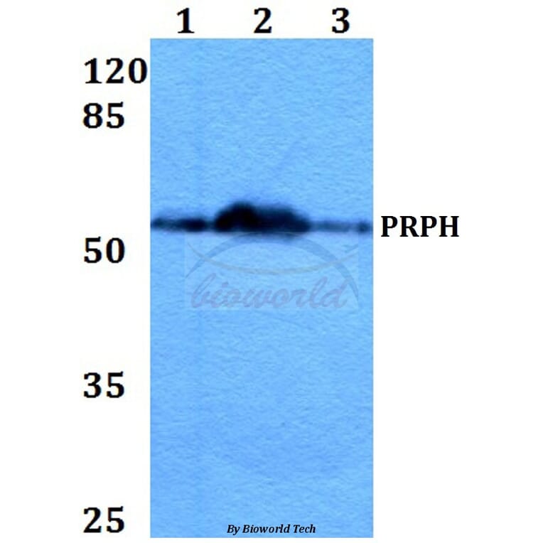 Anti-PRPH (S454) Antibody from Bioworld Technology (BS1292) - Antibodies.com