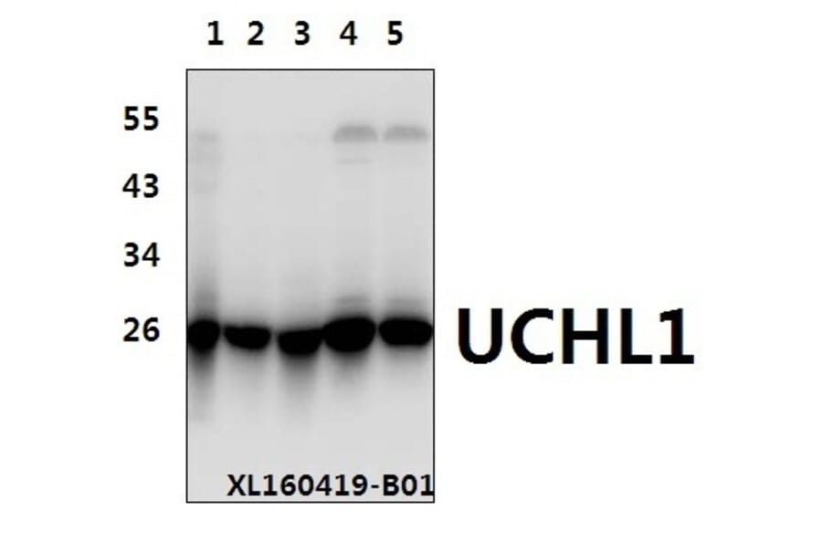 Anti-UCHL1 (R202) Antibody from Bioworld Technology (BS1293) - Antibodies.com