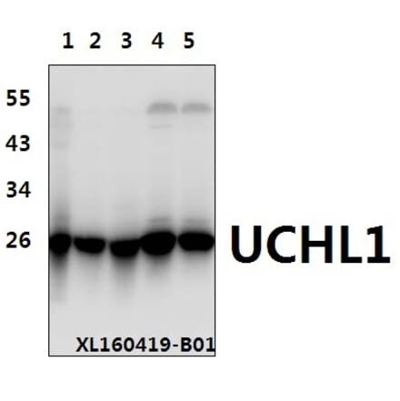 Anti-UCHL1 (R202) Antibody from Bioworld Technology (BS1293) - Antibodies.com
