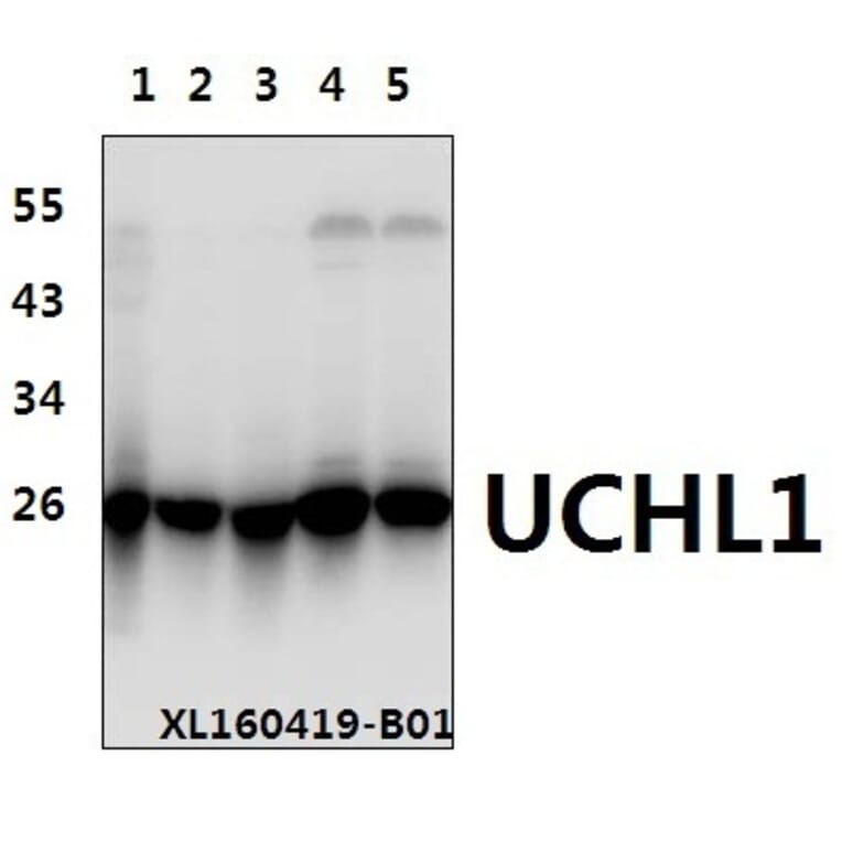 Anti-UCHL1 (R202) Antibody from Bioworld Technology (BS1293) - Antibodies.com