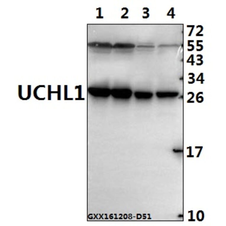 Anti-UCHL1 (R202) Antibody from Bioworld Technology (BS1293) - Antibodies.com