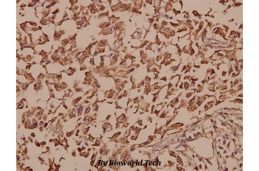 Anti-UCHL1 (R202) Antibody from Bioworld Technology (BS1293) - Antibodies.com