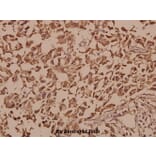 Anti-UCHL1 (R202) Antibody from Bioworld Technology (BS1293) - Antibodies.com