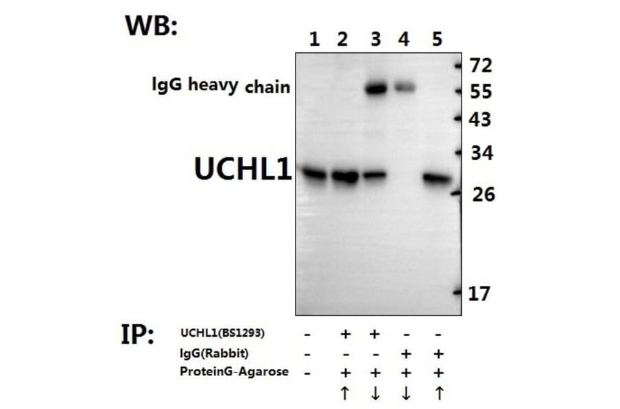 Anti-UCHL1 (R202) Antibody from Bioworld Technology (BS1293) - Antibodies.com