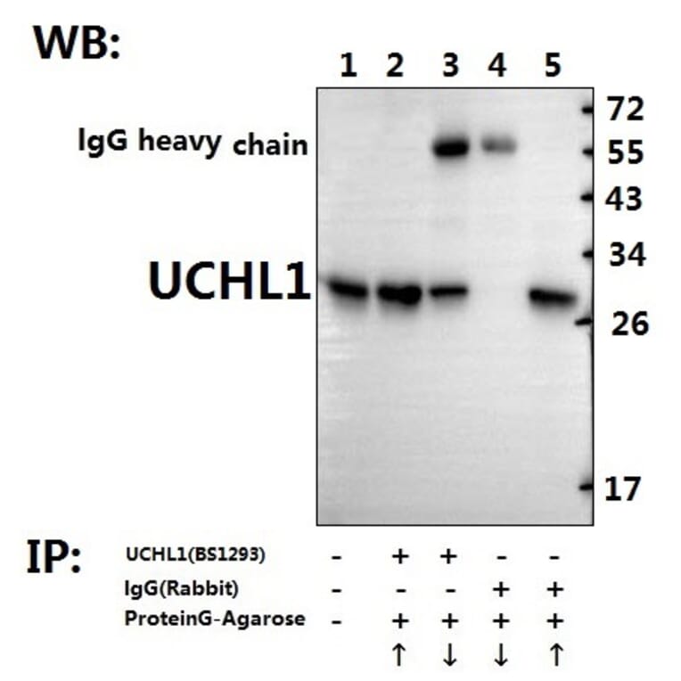 Anti-UCHL1 (R202) Antibody from Bioworld Technology (BS1293) - Antibodies.com