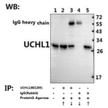 Anti-UCHL1 (R202) Antibody from Bioworld Technology (BS1293) - Antibodies.com