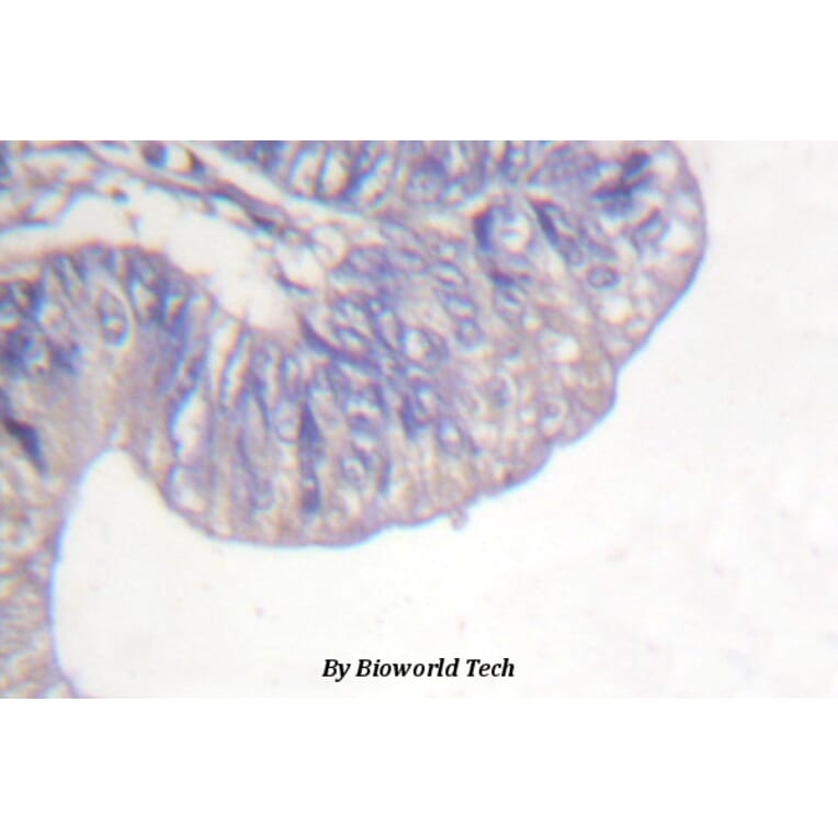 Anti-PLC γ1 (G777) Antibody from Bioworld Technology (BS1295) - Antibodies.com