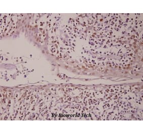 Anti-PML (P39) Antibody from Bioworld Technology (BS1296) - Antibodies.com