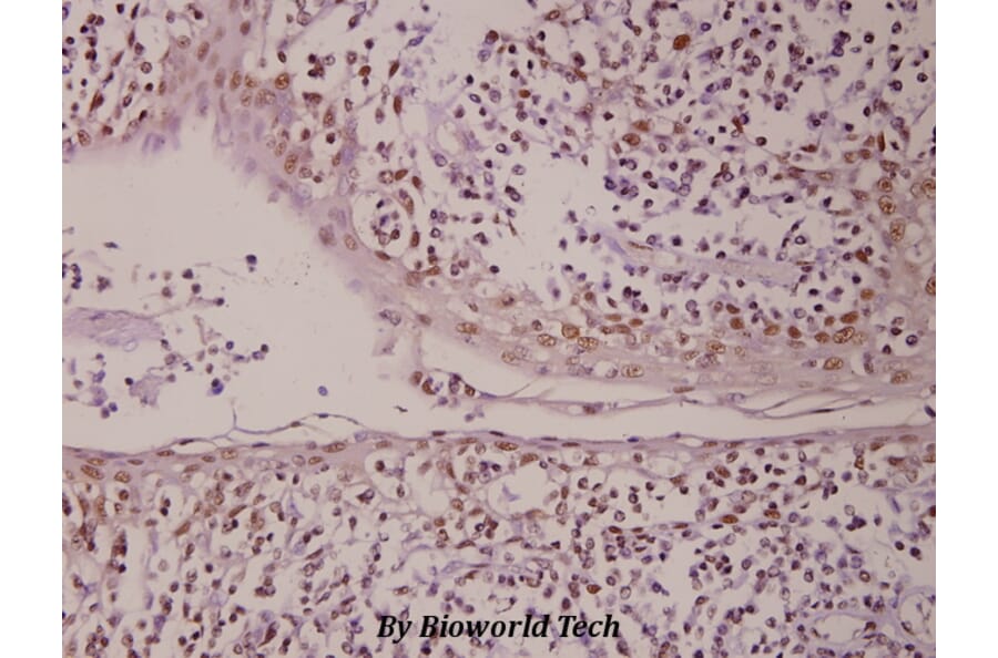 Anti-PML (P39) Antibody from Bioworld Technology (BS1296) - Antibodies.com