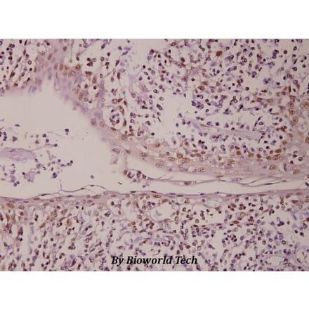 Anti-PML (P39) Antibody from Bioworld Technology (BS1296) - Antibodies.com