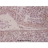 Anti-PML (P39) Antibody from Bioworld Technology (BS1296) - Antibodies.com