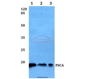 Anti-PSCA (V71) Antibody from Bioworld Technology (BS1301) - Antibodies.com