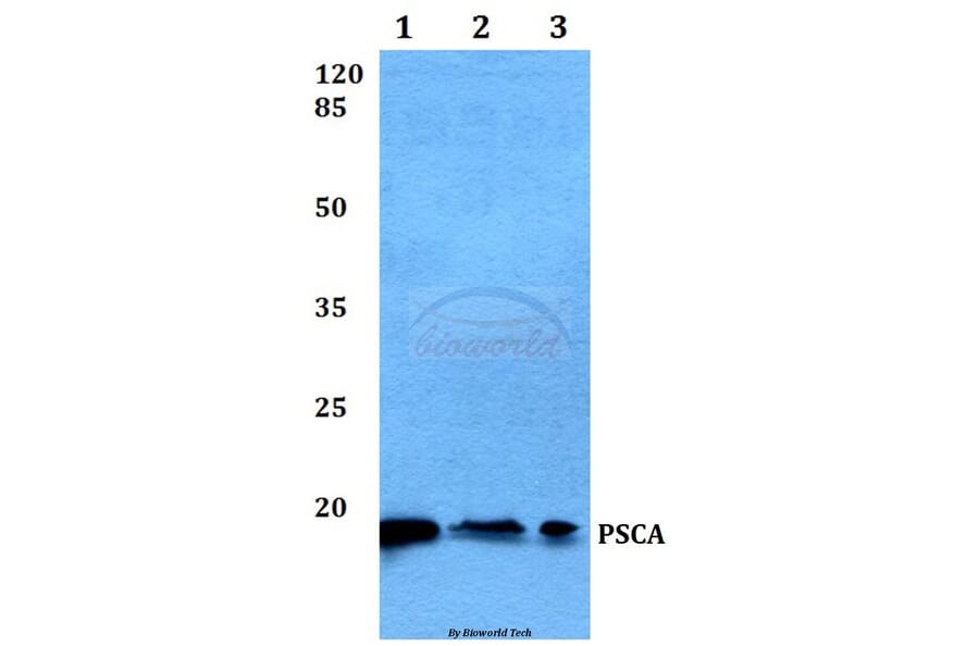 Anti-PSCA (V71) Antibody from Bioworld Technology (BS1301) - Antibodies.com