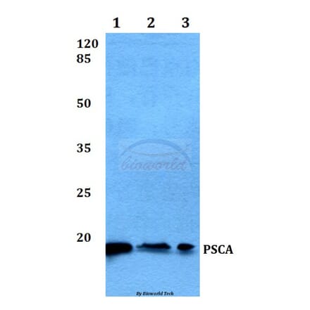 Anti-PSCA (V71) Antibody from Bioworld Technology (BS1301) - Antibodies.com