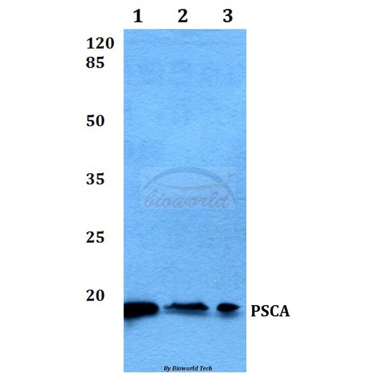 Anti-PSCA (V71) Antibody from Bioworld Technology (BS1301) - Antibodies.com