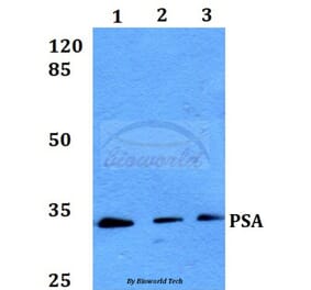Anti-PSA (L106) Antibody from Bioworld Technology (BS1302) - Antibodies.com