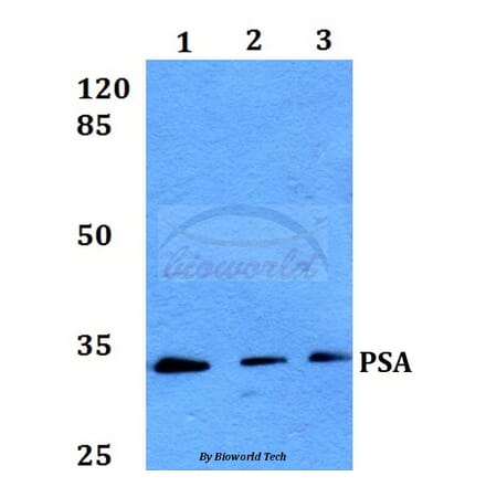 Anti-PSA (L106) Antibody from Bioworld Technology (BS1302) - Antibodies.com