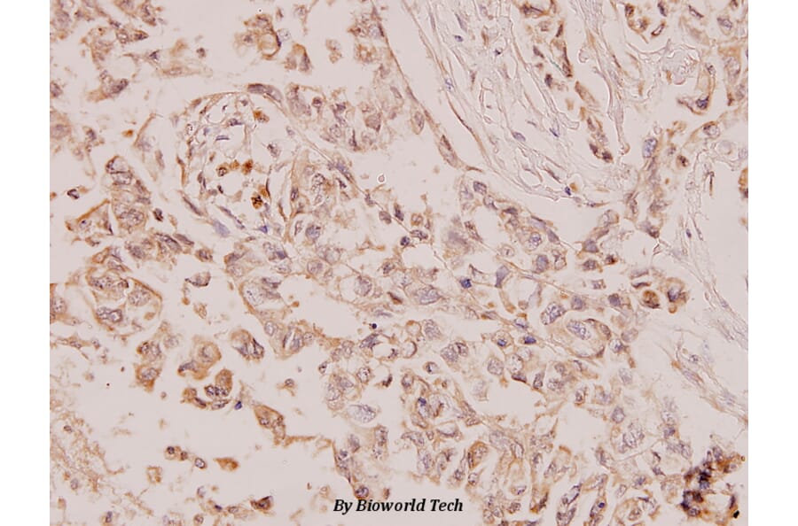 Anti-PTEN (S364) Antibody from Bioworld Technology (BS1303) - Antibodies.com