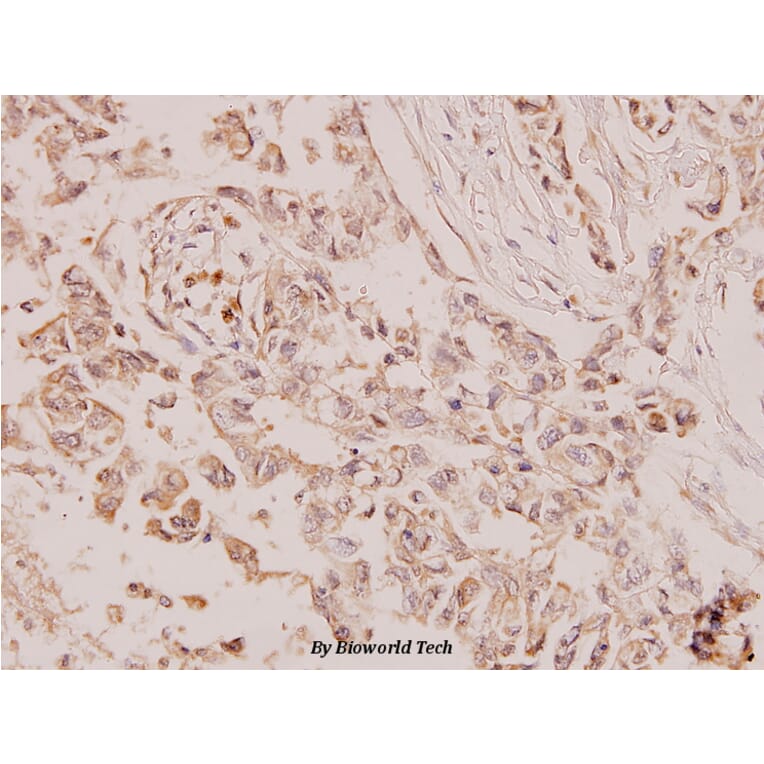 Anti-PTEN (S364) Antibody from Bioworld Technology (BS1303) - Antibodies.com