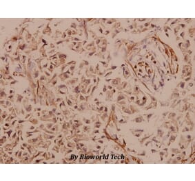 Anti-PYK2 (R875) Antibody from Bioworld Technology (BS1306) - Antibodies.com