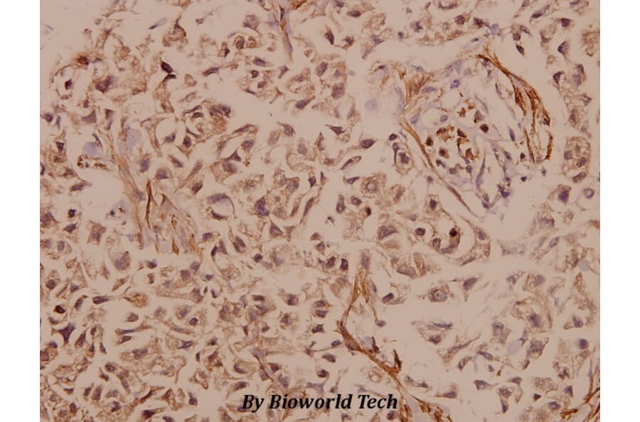 Anti-PYK2 (R875) Antibody from Bioworld Technology (BS1306) - Antibodies.com