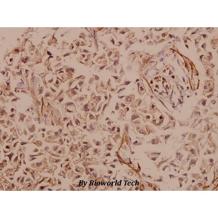Anti-PYK2 (R875) Antibody from Bioworld Technology (BS1306) - Antibodies.com