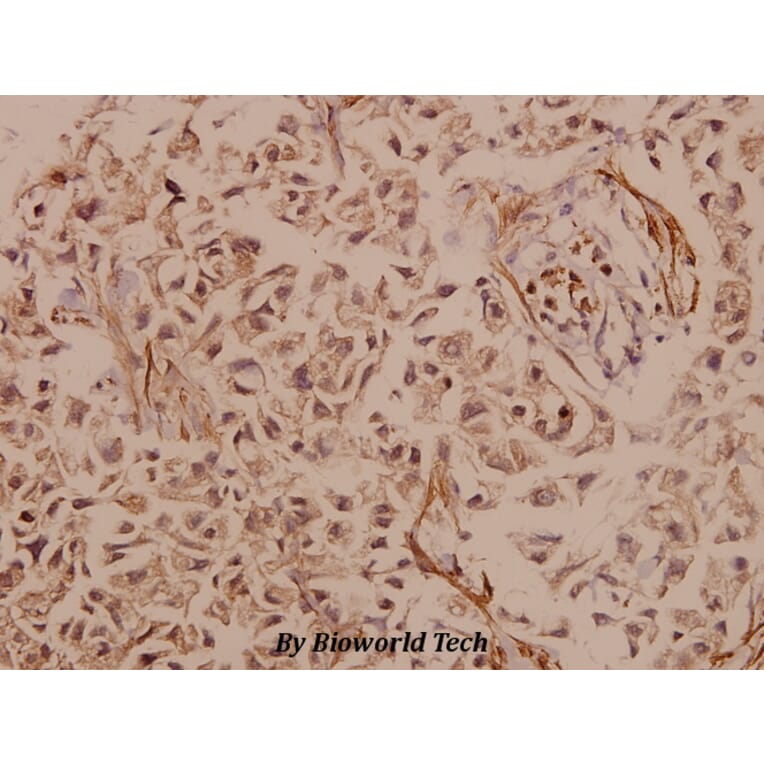 Anti-PYK2 (R875) Antibody from Bioworld Technology (BS1306) - Antibodies.com