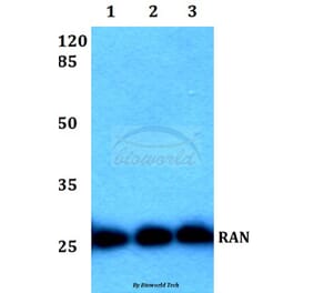 Anti-RAN (E202) Antibody from Bioworld Technology (BS1308) - Antibodies.com