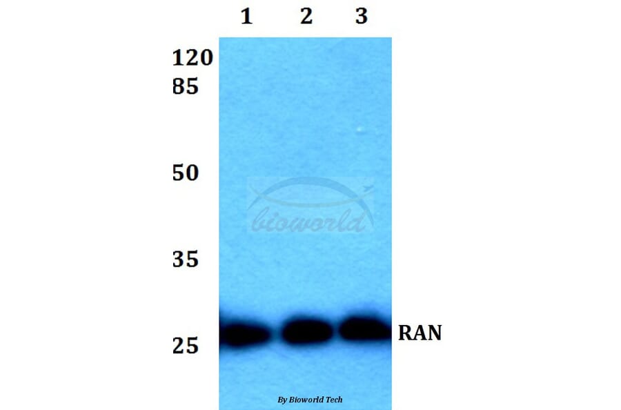 Anti-RAN (E202) Antibody from Bioworld Technology (BS1308) - Antibodies.com
