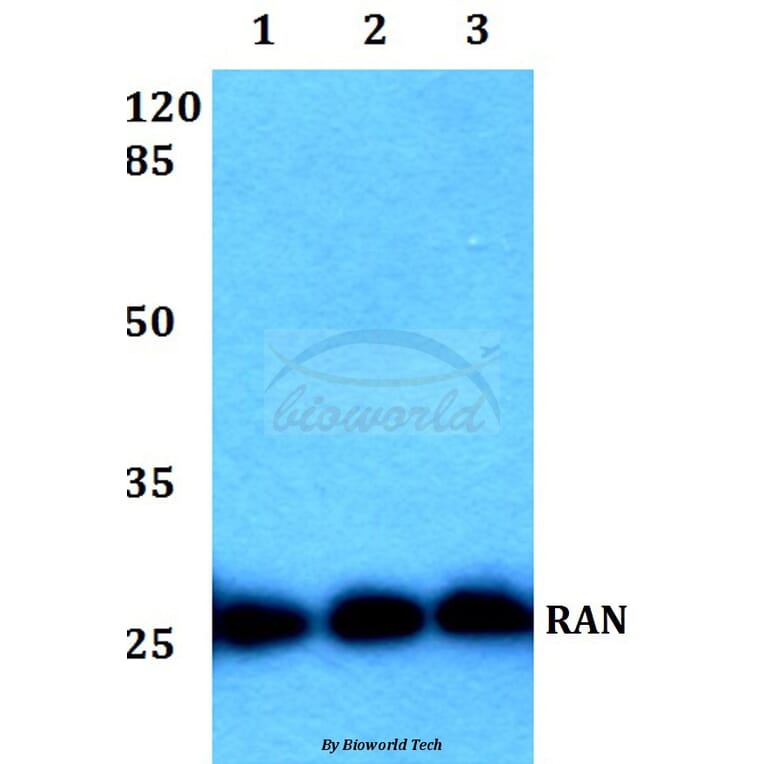 Anti-RAN (E202) Antibody from Bioworld Technology (BS1308) - Antibodies.com