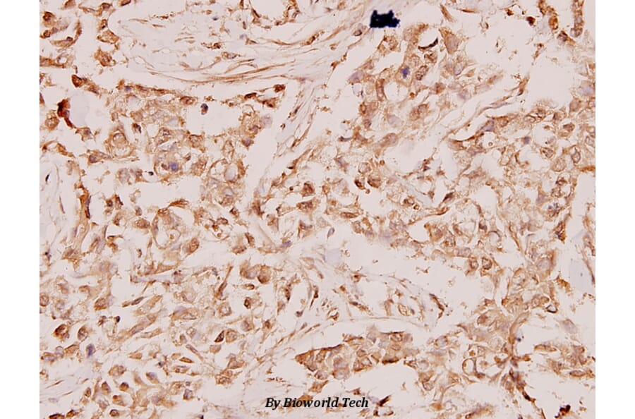 Anti-RAN (E202) Antibody from Bioworld Technology (BS1308) - Antibodies.com