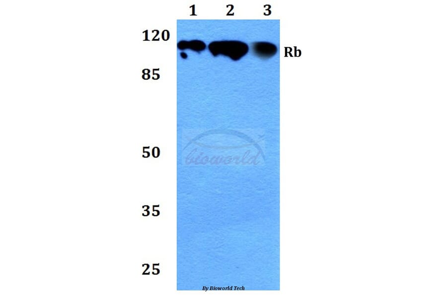 Anti-Rb (P789) Antibody from Bioworld Technology (BS1311) - Antibodies.com