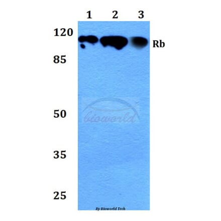 Anti-Rb (P789) Antibody from Bioworld Technology (BS1311) - Antibodies.com
