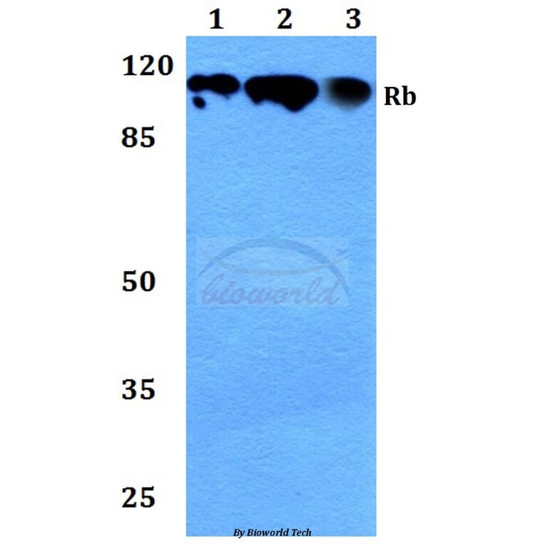 Anti-Rb (P789) Antibody from Bioworld Technology (BS1311) - Antibodies.com
