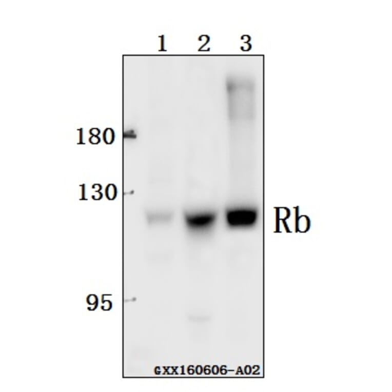 Anti-Rb (P789) Antibody from Bioworld Technology (BS1311) - Antibodies.com