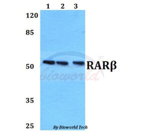 Anti-RARβ (L359) Antibody from Bioworld Technology (BS1315) - Antibodies.com