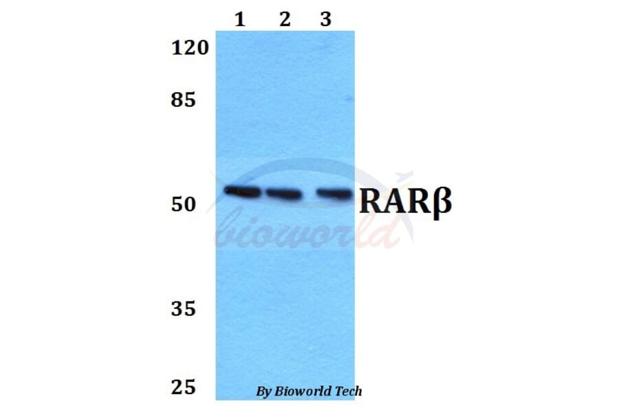 Anti-RARβ (L359) Antibody from Bioworld Technology (BS1315) - Antibodies.com