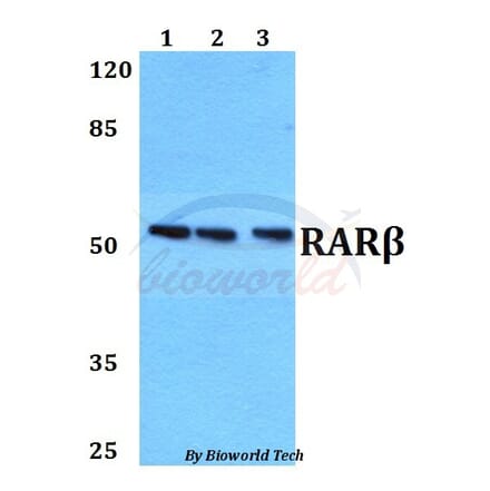 Anti-RARβ (L359) Antibody from Bioworld Technology (BS1315) - Antibodies.com
