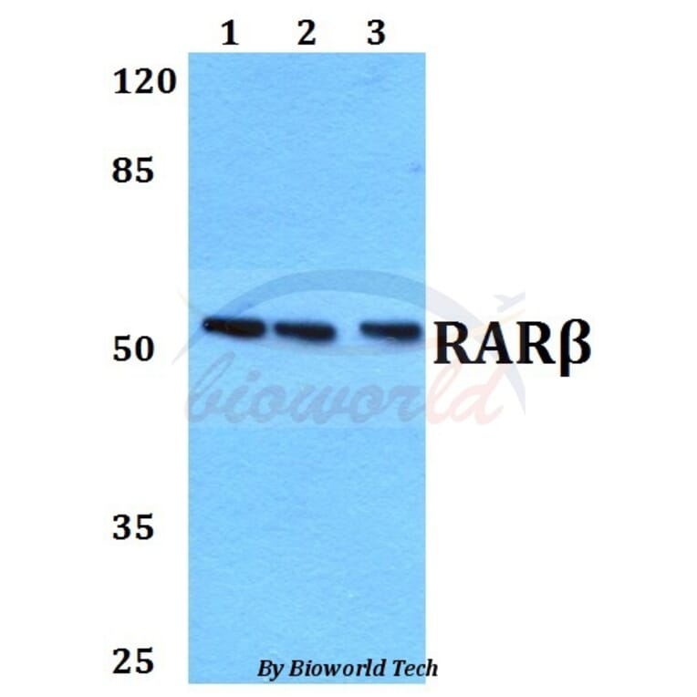 Anti-RARβ (L359) Antibody from Bioworld Technology (BS1315) - Antibodies.com