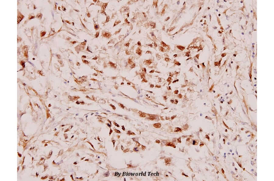 Anti-RARβ (L359) Antibody from Bioworld Technology (BS1315) - Antibodies.com